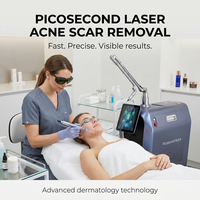 Machine de suppression de tatouages au laser Nd Yag Q-Switch picoseconde 755nm, système de beauté pour le peeling au carbone et la pigmentation