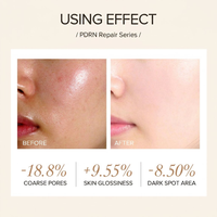 Ensemble de soins du visage nourrissant BEIHAO PDRN, réparation de la peau, extrait de Centella Asiatica pour femmes, hydratant, apaisant, réparation en profondeur