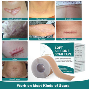 Parches de Silicona para Cicatrices de Grado Médico, Empaque OEM, Adecuados para la Cara, para Cicatrices Quirúrgicas - Product Image 3