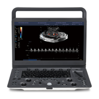 Échographe vétérinaire portable SonoScape Ultrasound E1 ExpV, Doppler couleur, E1 Exp pour l'imagerie diagnostique animale