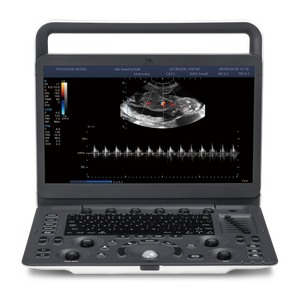 Ecógrafo Portátil <span class=keywords><strong>SonoScape</strong></span> <span class=keywords><strong>E1</strong></span> ExpV con Doppler Color para Diagnóstico Veterinario - Product Image 2