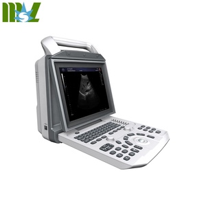 Machine vétérinaire portative d'échographie de couleur de grossesse et utilisée pour l'examen clinique d'ultrasons Zoncare I50 - Product Image 1
