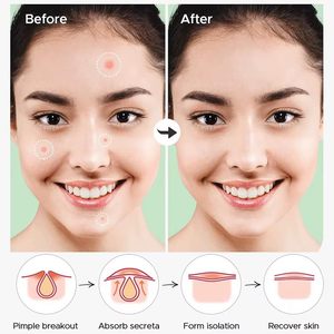 36 Capsules de Patchs Anti-Acné Invisibles et Respirants à Effet Correcteur, Enrichis aux Huiles Essentielles pour le Soin de la Peau - Product Image 3