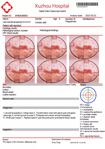 Colposcope vidéo HD original Colposcopio vidéo numérique Edan Colposcope fabricants Gynecozlogy Colposcope optique KN-2200B - Product Image 6