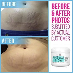 Crème réparatrice naturelle biologique à étiquette privée, anti-vergetures, réparation des vergetures, crème réparatrice des cicatrices, crème anti-vergetures de <span class=keywords><strong>grossesse</strong></span> - Product Image 6