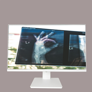Tốt nhất bán 24 inch 1920x1080 Độ phân giải 60Hz y tế cấp Màn hình <span class=keywords><strong>LCD</strong></span> cho laparoscope HD phẫu thuật hiển thị cho doanh nghiệp sử dụng - Product Image 2
