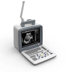 Thiết bị y tế LED xách tay máy siêu âm máy đầy đủ kỹ thuật số siêu âm hệ thống chẩn đoán - Product Image 4