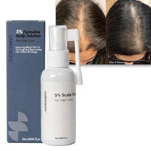 Thảo Dược Tự Nhiên Thành Phần Tóc Da Đầu Tăng Trưởng Phun Huyết Thanh Cho Nam Giới Và Phụ Nữ Nhanh Chóng Da Đầu Tăng Trưởng Dầu Điều Trị Vẻ Đẹp Sản Phẩm Sức Khỏe - Product Image 5