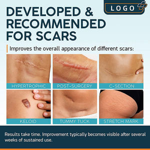 Keloid Gel Sheets số lượng lớn các mặt hàng bán buôn rất nhiều vết rạn da sẹo loại bỏ băng cho vết sẹo - Product Image 4
