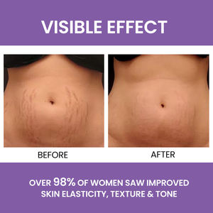 Lotion corporelle hydratante nourrissante naturelle végane à étiquette privée pour soulager les démangeaisons, éclaircir la peau et éliminer les vergetures pour les femmes enceintes - Product Image 4