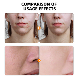 ODM OEM özel aydınlatma cilt zerdeçal yüz kremi askorbik asit krem lekeleri yüz kremi kaldırır - Product Image 5