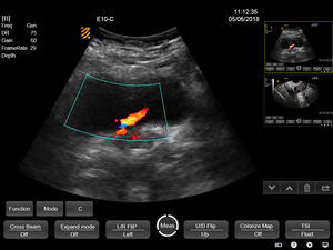Bmv PT50C teknologi canggih layar sentuh portabel dokter hewan Aria peralatan <span class=keywords><strong>Ultrasound</strong></span> untuk hewan peliharaan rumah sakit klinis kucing anjing - Product Image 3