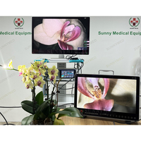 Sistema de cámara de endoscopia UHD Ultra HD profesional de gama alta, cámara endoscópica médica para cirugía veterinaria,