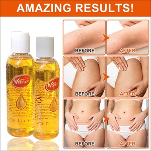 <span class=keywords><strong>Olio</strong></span> Essenziale Puro per Recupero Naturale, Rimozione Cicatrici, Idratante, Nutriente, Schiarente 100ml, Cura della Pelle per Donne in Gravidanza - Product Image 2