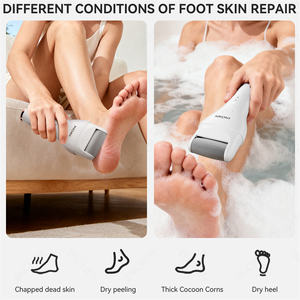 Removedor de Callos Eléctrico <span class=keywords><strong>Recargable</strong></span> por USB con 3 Cabezales, Resistente al Agua IPX6, 2 Velocidades Ajustables, 1 Año de Garantía - Product Image 2