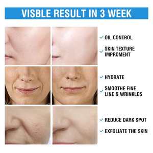 Tampons exfoliants doux et lisses pour le visage à l'acide salicylique-glycolique, personnalisés OEM/ODM, en <span class=keywords><strong>coton</strong></span> - Product Image 5