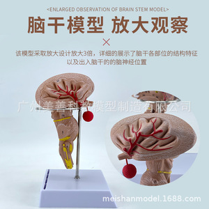 Modèle d'amplification du tronc cérébral, modèle du tronc cérébral, modèle anatomique du tronc cérébral, modèle cérébral, modèle d'artère cérébrale, modèle cérébral - Product Image 2