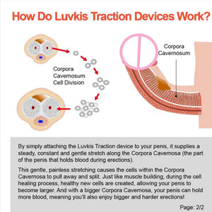 拡大ペニスエクステンダーペニスポンプ拡大ストレッチャー男性強化キット男性ペニスエクステンダーアクセサリー大人の大人のおもちゃ - Product Image 2