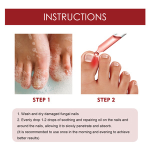 Esencia para el Cuidado de los Pies con Hongos, Gel para Eliminar Hongos de los Dedos de los Pies, Aceite para el Cuidado Anti-Infecciones - Product Image 4