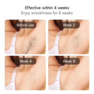 Appareil d'épilation au laser IPL à refroidissement saphir <span class=keywords><strong>professionnel</strong></span> Mlay T25, épilateur domestique indolore pour l'épilation du corps - Product Image 5