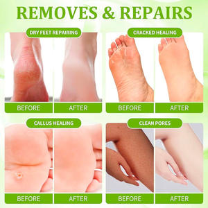 Crème pour les pieds parfumée aux fruits personnalisée OEM, noix <span class=keywords><strong>de</strong></span> coco et mangue, hydratante, réparation en profondeur pour les talons secs et gercés, avec emballage complet en anglais - Product Image 3