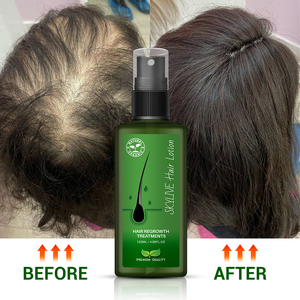 Alta Qualidade Cabelo Loção 120ml Tratamento Do Cabelo <span class=keywords><strong>Neem</strong></span> <span class=keywords><strong>Oil</strong></span> <span class=keywords><strong>Genuine</strong></span> Made in Thailand Crescimento Do Cabelo Essence Spray