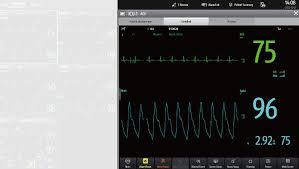 Sistema de Telemetría Veterinaria Mindray TMS30, Sistema Inalámbrico de Monitoreo de Pacientes para Hospitales de Animales - Product Image 6