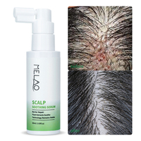 Produits de traitement des cheveux anti-chute personnalisés Sérum apaisant pour la croissance des cheveux, hydratant, shampoing, soins du cuir chevelu