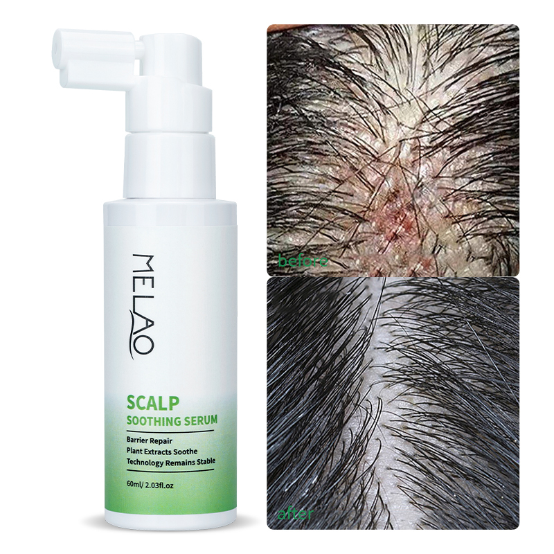 Hair Care Products Rosemary Essential Oil