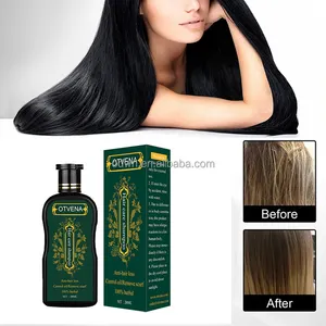 Shampoo e balsamo per la caduta dei capelli femminili all'ingrosso shampoo e balsamo per la crescita dei capelli