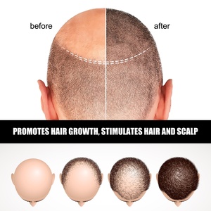 Serum Ampul Penumbuh Rambut Herbal Alami Jaysuing 100% Profesional Mempercepat Pertumbuhan, Menutrisi, dan Menyegarkan - Product Image 5