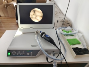 Conjunto de cámara de endoscopia <span class=keywords><strong>integrada</strong></span> médica 4 en 1 para Urología/laparoscopia - Product Image 6