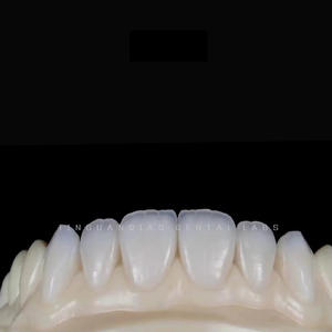 Dentiera denti finti fissi Zirconia denti corone & ponti laboratorio dentale cinese con la migliore qualità - Product Image 6