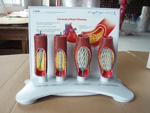 Modelo Anatómico de <span class=keywords><strong>Stent</strong></span> Vascular Humano Huichun SMM3192 (PVC) para Educación en Ciencias Médicas - Arteria Coronaria - Product Image 3