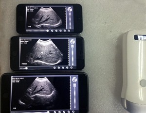 Mesin <span class=keywords><strong>Ultrasound</strong></span> Genggam Mini WiFi Nirkabel, Pemindai <span class=keywords><strong>Ultrasound</strong></span> B/M - Product Image 6