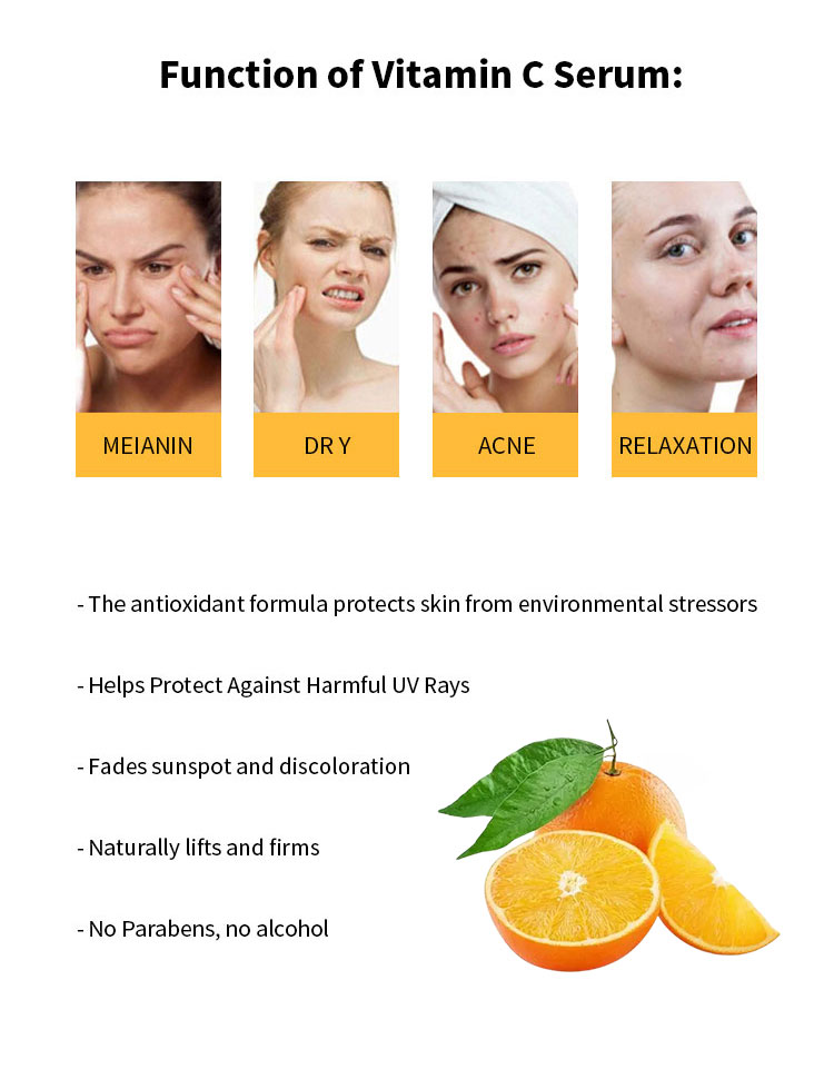 Sell acne scar, stretch marks remove cream skin repair Korean cream