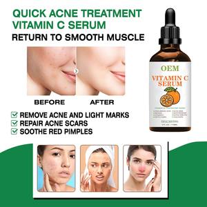 Suero Iluminador Premium con Vitamina C: Glicerina y <span class=keywords><strong>Ácido</strong></span> Hialurónico para Hidratación Diaria, Unifica el Tono de la Piel, Reduce las Manchas Oscuras - Product Image 3