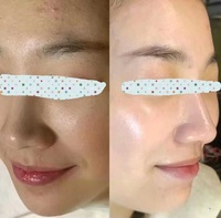 Sérum Éclaircissant Puissant au Glutathion en Gros avec Vitamine C et Concentré d'Acide Tranexamique – Ampoule Sérum Éclaircissant pour le Visage
