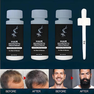 OEM <strong>5</strong>% Pure <strong>Biotin</strong> Nature Organic Hair Growth Serum Kit 60ml Herbal Booster Oil for Dry Hair Hair-Loss Prevention Repair - Product Image 6