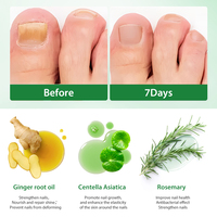 Essence de réparation des ongles en 7 jours, rapide et efficace, nourrit naturellement les ongles abîmés, solution nutritive, essence de réparation des ongles