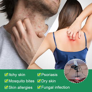 Crema ZB per Psoriasi, Dermatite ed Eczema, Unguento Erboristico Antibatterico Anti-Prurito per Eczema Cutaneo - Product Image 4