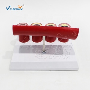 Anatomy Various Stages <strong>Pathological</strong> Blood Anatomy Model Education Science Model Vascular Disease Model