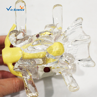 Modelo de demostración de hernia de disco lumbar modelo de articulación anatómica de esqueleto humano para ciencia médica
