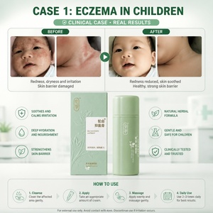 <span class=keywords><strong>Crema</strong></span> per Emorroidi YIHE-HEALTH, <span class=keywords><strong>Crema</strong></span> Riparatrice per la Pelle a Base di Erbe Cinesi - Product Image 2