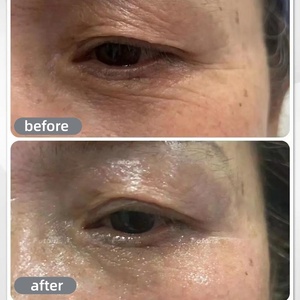 Crème liftante instantanée pour les yeux effet Botox, anti-<span class=keywords><strong>rides</strong></span>, à base de peptides, effet tenseur, Acetyl Hexapeptide-8, crème anti-âge pour éliminer les <span class=keywords><strong>rides</strong></span> du contour des yeux - Product Image 3