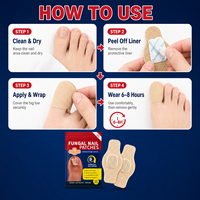 Traitement Efficace Antifongique pour les Ongles CL : Gel et Patch, Durée de Conservation de 2 Ans, OEM/ODM Disponible