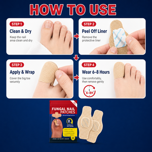 Traitement Efficace <span class=keywords><strong>Antifongique</strong></span> pour les Ongles CL : Gel et Patch, Durée de Conservation de 2 Ans, OEM/ODM Disponible - Product Image 4