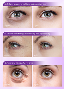 Crema Contorno de Ojos Antiarrugas Instantánea OEM/ODM, Ácido Hialurónico, Vitamina C, Orgánica, Vegana, Herbal, Elimina Bolsas en los Ojos, Ojeras, Reafirmante - Product Image 3