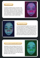 Analyseur intelligent de peau et de cuir chevelu Ai, équipement de diagnostic cutané par imagerie spectrale 9 spectres, analyseur de peau numérique 3D