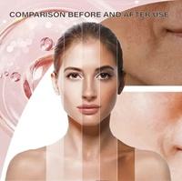 Gummies au collagène avec biotine et vitamine C pour femmes, adultes et adolescentes – Cheveux, peau, ongles – Complément vitaminique sans sucre